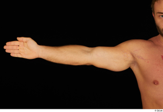 Herbert 10yers arm nude 0003.jpg